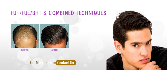 Midas Hair Clinic - FUE Hair Transplant in Bangalore | LLLT in Bangalore |  Low level Laser Therapy in Bangalore | Hair Transplant in India | Best Hair  Restoration clinic in Bangalore |